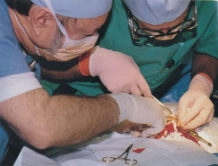 evidencia fisica el resultado de 17 cirugias son la extraccion de trece extranos implantes