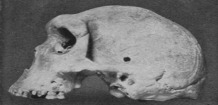 Agujero de bala en cráneo prehistórico de millones de años.